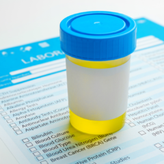 what your urine says about your health